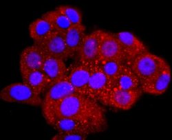 Aquaporin 1/AQP1 Antibody (JM10-98), Novus Biologicals 100&mu;L:Antibodies,