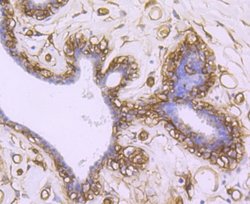Aquaporin 1/AQP1 Antibody (JM10-98), Novus Biologicals 100&mu;L:Antibodies,