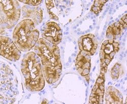 Aquaporin 1/AQP1 Antibody (JM10-98), Novus Biologicals 100&mu;L:Antibodies,