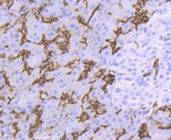 Aquaporin 1/AQP1 Antibody (JM10-98), Novus Biologicals 100&mu;L:Antibodies,