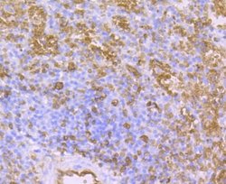 Aquaporin 1/AQP1 Antibody (JM10-98), Novus Biologicals 100&mu;L:Antibodies,