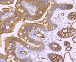 Aquaporin 1/AQP1 Antibody (JM10-98), Novus Biologicals 100&mu;L:Antibodies,