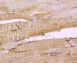 Aquaporin 1/AQP1 Antibody (JM10-98), Novus Biologicals 100&mu;L:Antibodies,