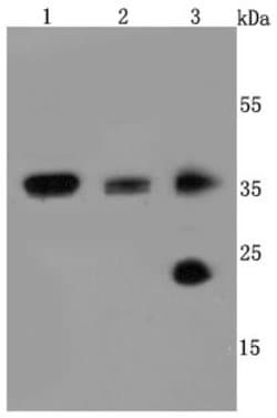 Aquaporin 1/AQP1 Antibody (JM10-98), Novus Biologicals 100&mu;L:Antibodies,
