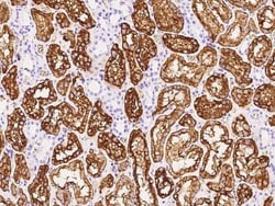 Aquaporin 1/AQP1 Antibody, Novus Biologicals 100 &mu;g, Unconjugated:Anticorps,