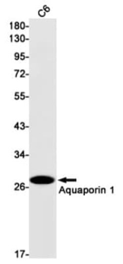 Aquaporin 1/AQP1 Antibody (S03-7G5), Novus Biologicals 50 &mu;g; Unconjugated:Antibodies,