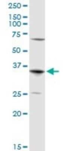 Aquaporin-7 Antibody, Novus Biologicals 0.1 mg | Buy Online | Novus Biologicals | Fisher Scientific