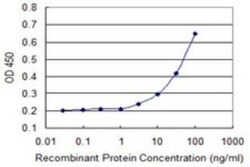 Aquaporin-8 Antibody (1A1), Novus Biologicals 0.1 mg | Buy Online | Novus Biologicals | Fisher Scientific