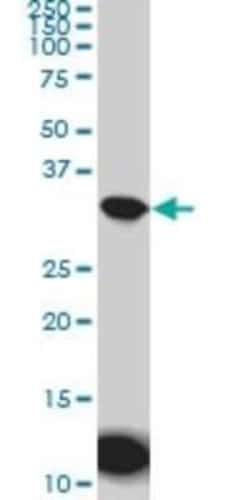 Aquaporin-8 Antibody (1A1), Novus Biologicals 0.1 mg | Buy Online | Novus Biologicals | Fisher Scientific