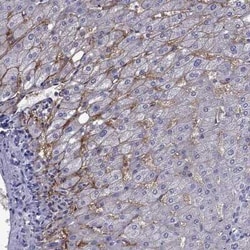 Aquaporin-9 Antibody, Novus Biologicals:Antibodies:Primary Antibodies