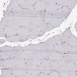 Aquaporin-9 Antibody, Novus Biologicals:Antibodies:Primary Antibodies