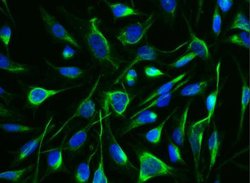 Arginase 1/ARG1/liver Arginase Rabbit anti-Human, Clone: 34, Novus Biologicals