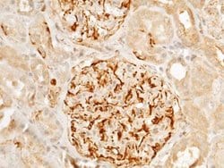 Arginase 1/ARG1/liver Arginase Rabbit anti-Human, Clone: 34, Novus Biologicals