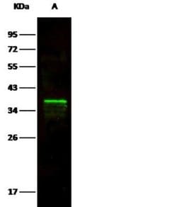 Arginase 1/ARG1/liver Arginase Rabbit anti-Human, Clone: 34, Novus Biologicals
