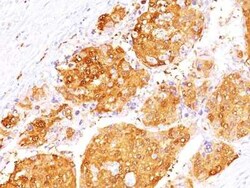 Arginase 1/ARG1/liver Arginase Antibody (ARG1/1125 + ARG1/1126), Novus