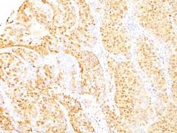 Arginase 1/ARG1/liver Arginase Antibody (ARG1/1125 + ARG1/1126), Novus