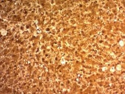 Arginase 1/ARG1/liver Arginase Antibody (ARG1/1126), Novus Biologicals:Antibodies:Primary