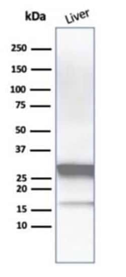 Arginase 1/ARG1/liver Arginase Antibody (ARG1/1126), Novus Biologicals:Antibodies:Primary