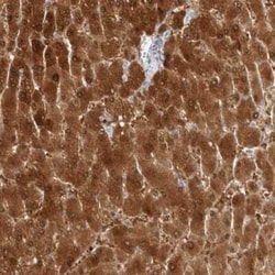 Arginase 1/ARG1/liver Arginase Antibody, Novus Biologicals 25 &mu;L; Unconjugated:Antibodies,