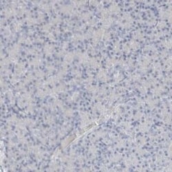 Arginase 1/ARG1/liver Arginase Antibody, Novus Biologicals 25 &mu;L; Unconjugated:Antibodies,