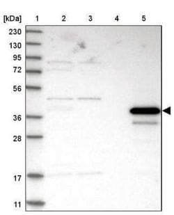Arginase 1/ARG1/liver Arginase Antibody, Novus Biologicals 25 &mu;L; Unconjugated:Antibodies,
