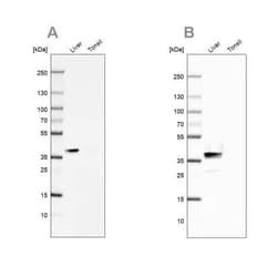 Arginase 1/ARG1/liver Arginase Antibody, Novus Biologicals 25 &mu;L; Unconjugated:Antibodies,