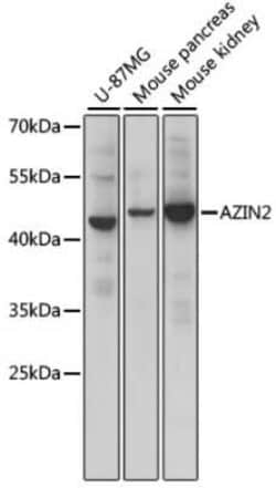 Arginine decarboxylase Antibody - Azide and BSA Free, Novus Biologicals:Antibodies:Primary