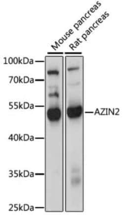 Arginine decarboxylase Antibody - Azide and BSA Free, Novus Biologicals