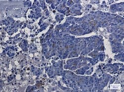 Argininosuccinate Synthase Antibody (S02-7A8), Novus Biologicals 50 &mu;g;