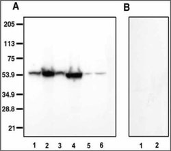 Aromatase Antibody (H4) - Azide and BSA Free, Novus Biologicals 0.1mg:Antibodies,
