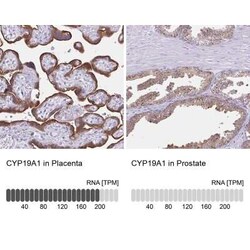 Aromatase Antibody, Novus Biologicals:Antibodies:Primary Antibodies