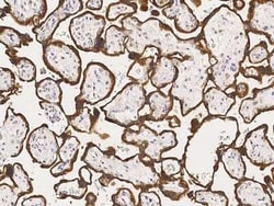 Aromatase Antibody, Novus Biologicals:Antibodies:Primary Antibodies