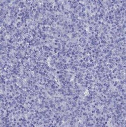 Arrestin 3 Antibody, Novus Biologicals:Antibodies:Primary Antibodies
