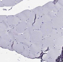 Arrestin 3 Antibody, Novus Biologicals:Antibodies:Primary Antibodies