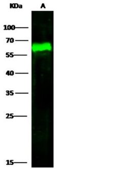 Arylsulfatase A/ARSA Rabbit anti-Human, Clone: 1, Novus Biologicals 100