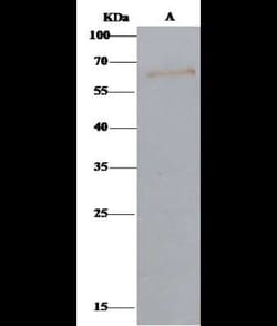 Arylsulfatase A/ARSA Antibody, Novus Biologicals:Antibodies:Primary Antibodies