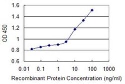 Arylsulfatase B/ARSB Antibody (2G6), Novus Biologicals 0.1 mg; Unconjugated:Anticorps,