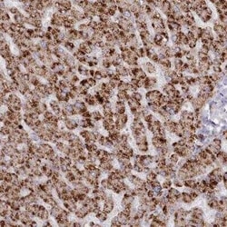 Arylsulfatase B/ARSB Antibody, Novus Biologicals 0.1 mL; Unconjugated:Antikörper
