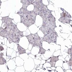 Arylsulfatase B/ARSB Antibody, Novus Biologicals 0.1 mL; Unconjugated:Antikörper