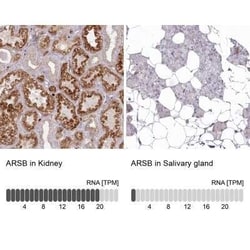 Arylsulfatase B/ARSB Antibody, Novus Biologicals 0.1 mL; Unconjugated:Antikörper