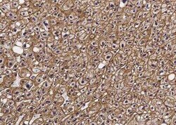 Asialoglycoprotein Receptor 2 Antibody (002), Novus Biologicals:Antibodies:Primary