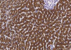 Asialoglycoprotein Receptor 2 Antibody (002), Novus Biologicals:Antibodies:Primary