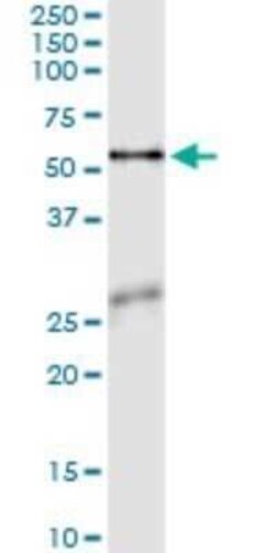 Asparagine synthetase Antibody (2B3), Novus Biologicals 0.1 mg | Buy Online | Novus Biologicals | Fisher Scientific
