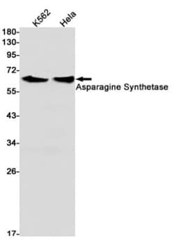 Asparagine synthetase Antibody (S05-9E5), Novus Biologicals:Antibodies:Primary