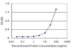 Aspartate Aminotransferase Antibody Pair, Novus Biologicals&trade;