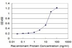 Aspartate beta hydroxylase Antibody (3G5), Novus Biologicals 0.1 mg; Unconjugated:Antibodies,