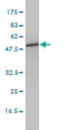 Aspartyl Aminopeptidase Antibody (2F9-3A7), Novus Biologicals 0.1 mg | Buy Online | Novus Biologicals | Fisher Scientific