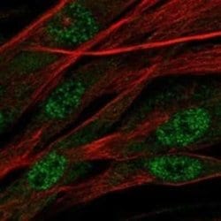 Asporin Rabbit anti-Human, Polyclonal, Novus Biologicals 100 &mu;g | Buy Online | Novus Biologicals | Fisher Scientific