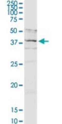 Novus Biologicals Asporin Antibody, Novus Biologicals 0.1 mg | Buy Online | Novus Biologicals&trade; | Fisher Scientific