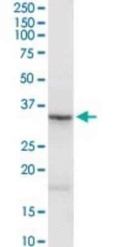 Novus Biologicals Asporin Antibody, Novus Biologicals 0.1 mg | Buy Online | Novus Biologicals&trade; | Fisher Scientific